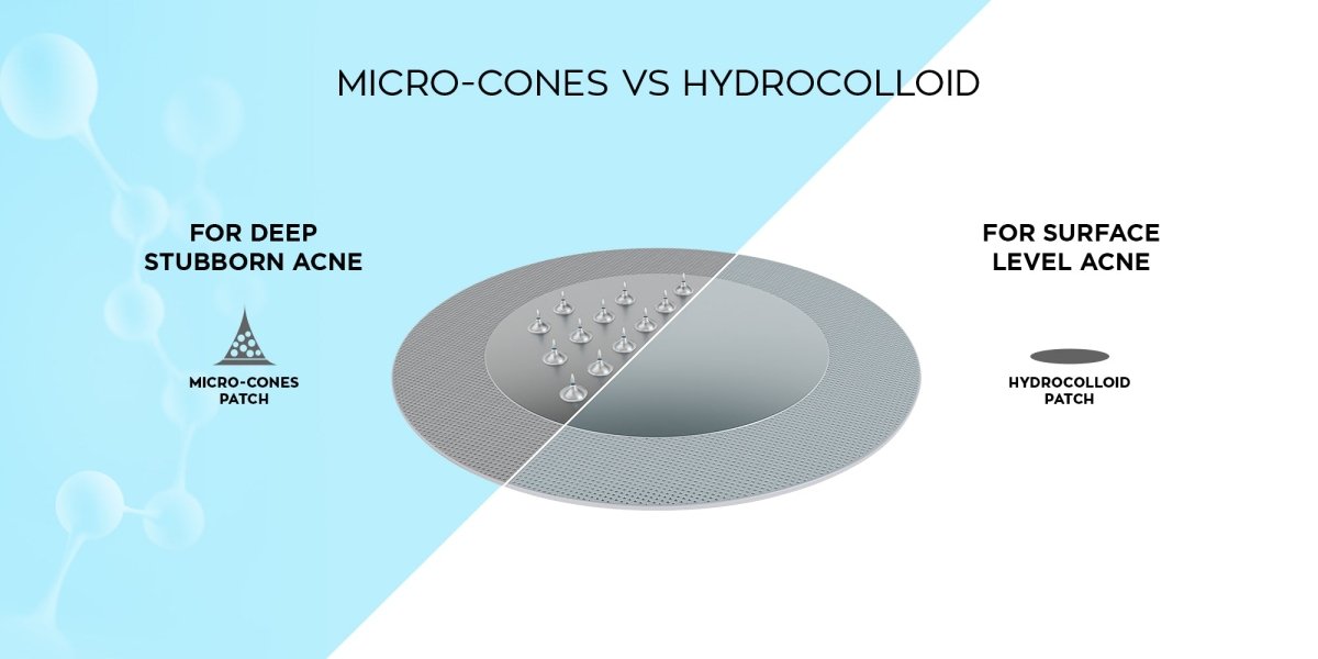 Hydrocolloid pimple patches and microneedle anti-ageing patches side by side comparison
