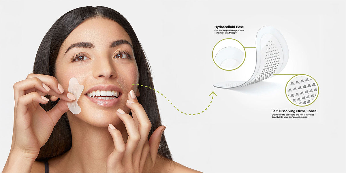 Microneedle patches compared to topical skincare creams and serums for deeper ingredient delivery