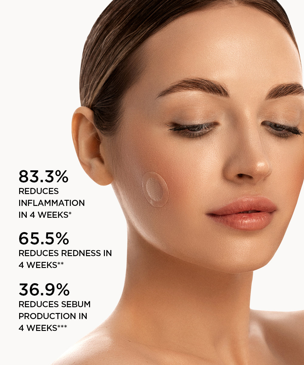 flawless results poster for acne treatment