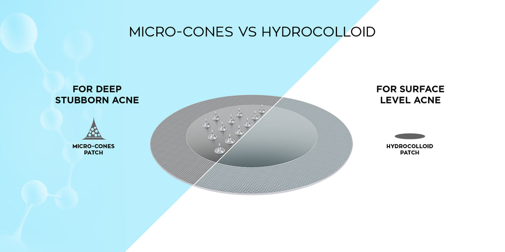 Hydrocolloid vs Microneedle Patches: Which Works Best for Your Skin?