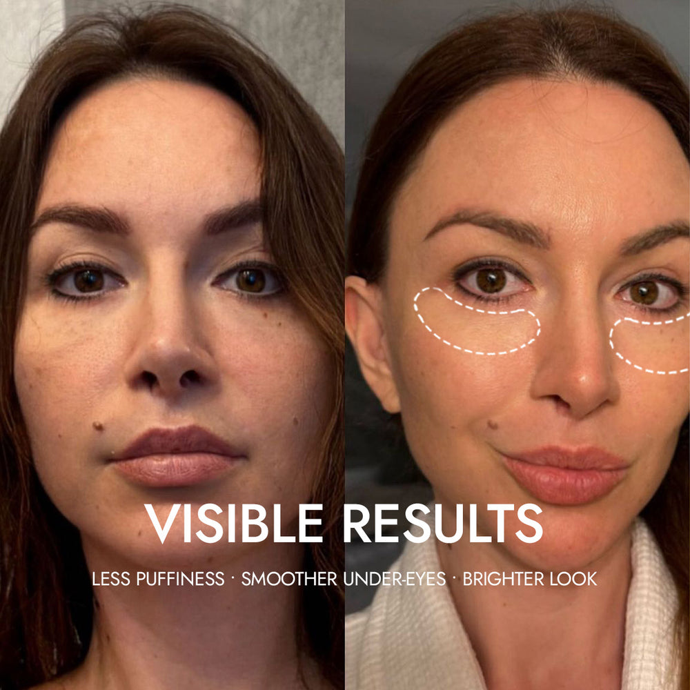 Find Your Ideal Skincare Routine